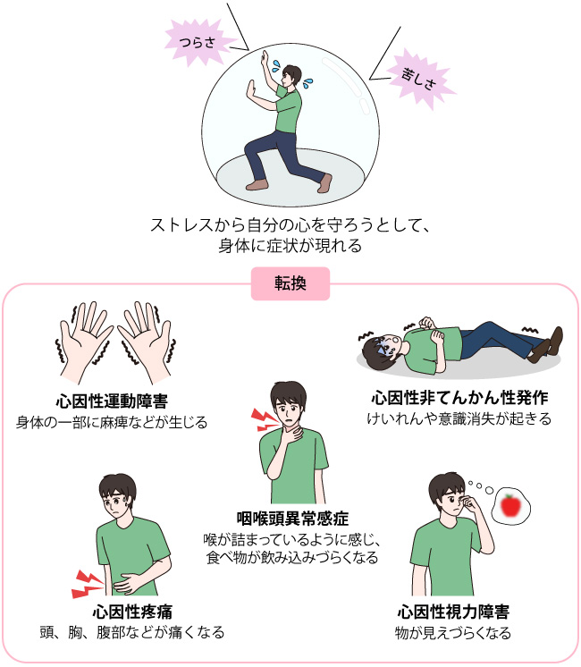 転換性障害 (てんかんせいしょうがい)とは | 済生会